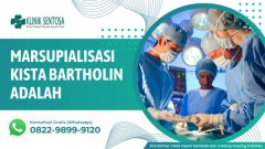 Marsupialisasi Kista Bartholin Adalah